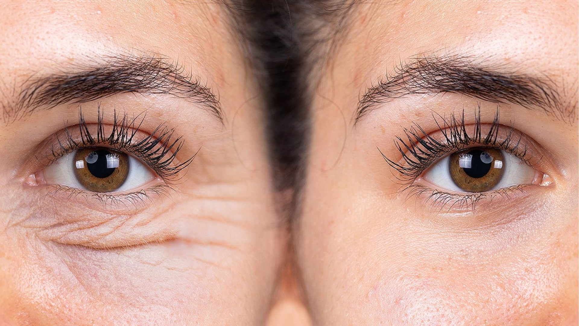 5 Secrets to Prevent Aging on Oily Skin for a Youthful Complexion